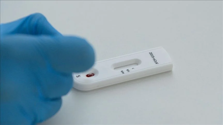 Bečki aerodrom snizio cijene testova